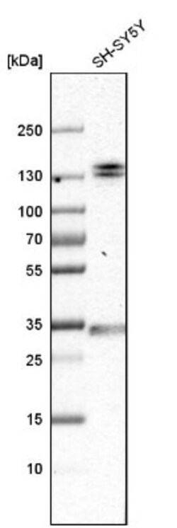 EMILIN1 Antibody, Novus Biologicals 0.1mL; Unlabeled:Antibodies, Polyclonal